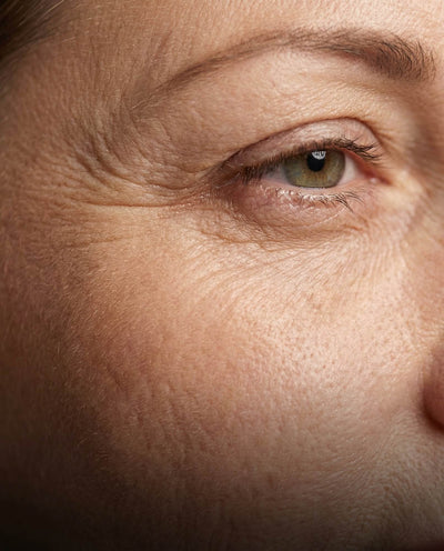 Slow aging & wrinkles